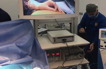 cirugía-por-laparoscopia-Cirugia-Bariatrica-IMObariatrica (pequeña)