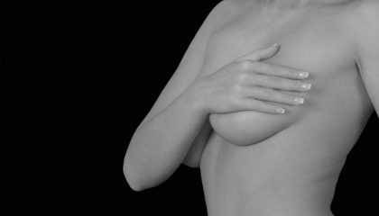 Mastopexia-mamoplastia-IMOBariatrica